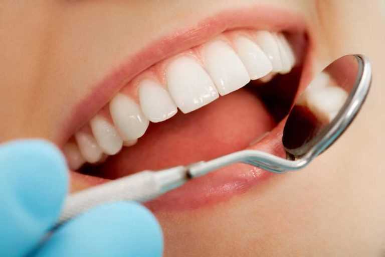 Secrets You Never Knew About Healthy Teeth