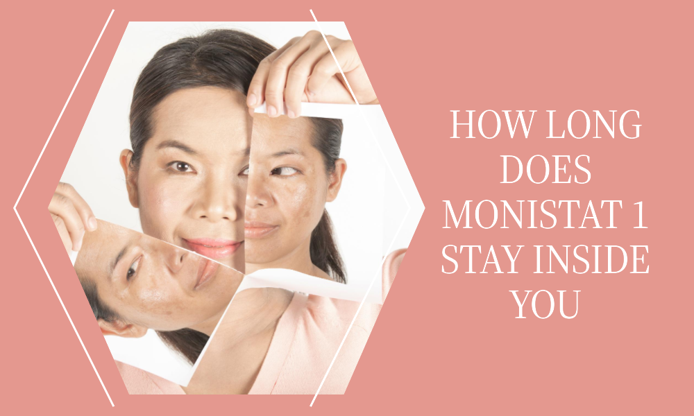 how long does monistat 1 stay inside you