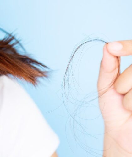 Hair Loss